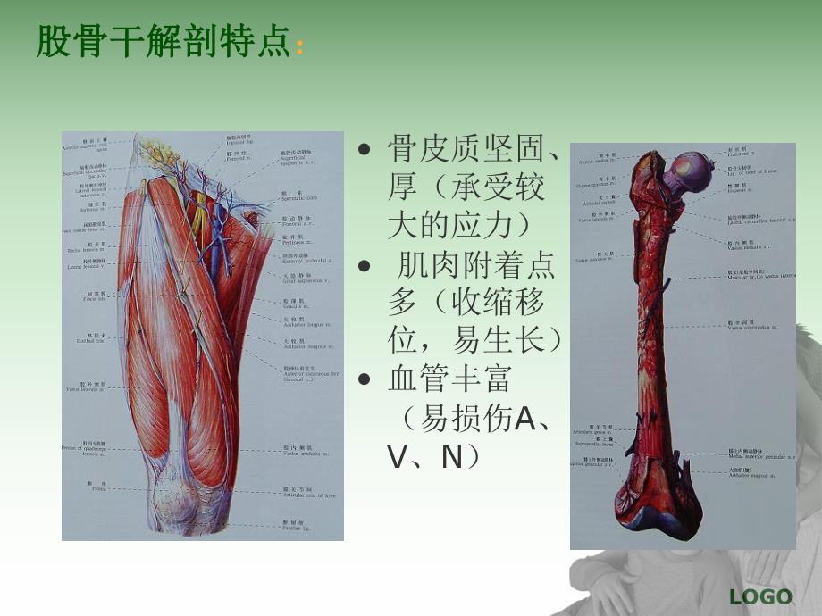 股骨干骨折的护理及功能锻炼.ppt_第3页