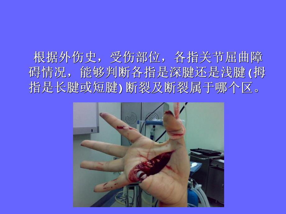 肌腱缝合技术.ppt_第2页