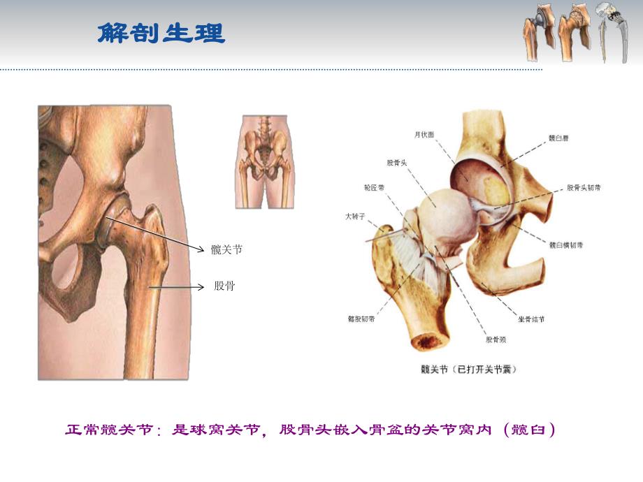 髋关节置换术后功能锻炼.ppt_第3页