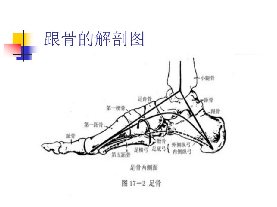 跟骨骨折病人的护理.ppt_第3页