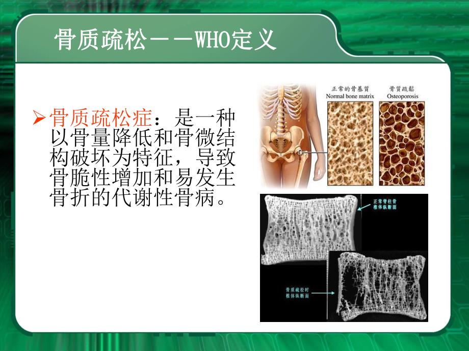 骨科常见病.ppt_第3页