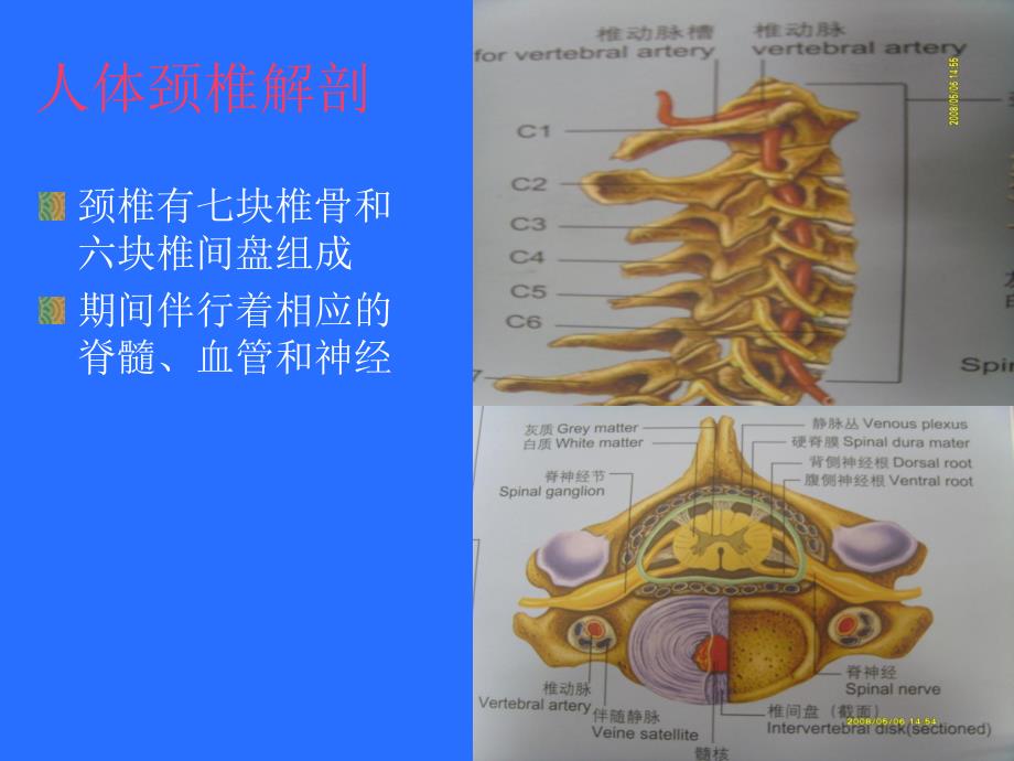 颈椎病的治疗与护理.ppt_第3页