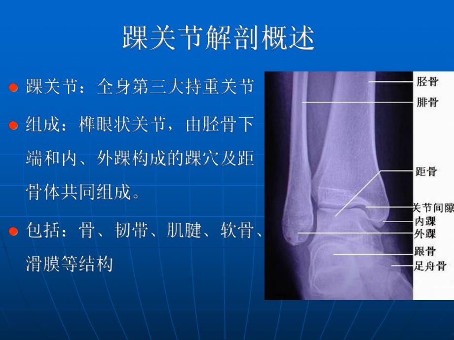 踝关节损伤磁共振诊断.ppt_第2页