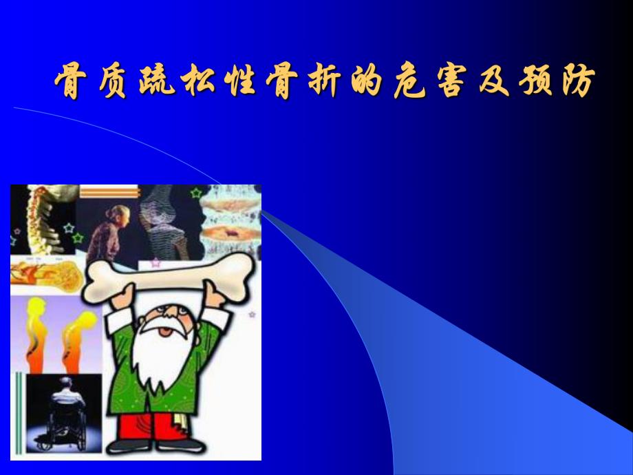 骨质疏松性骨折的危害及预防.ppt_第1页