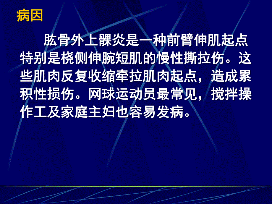 肱骨外上髁炎.ppt_第3页