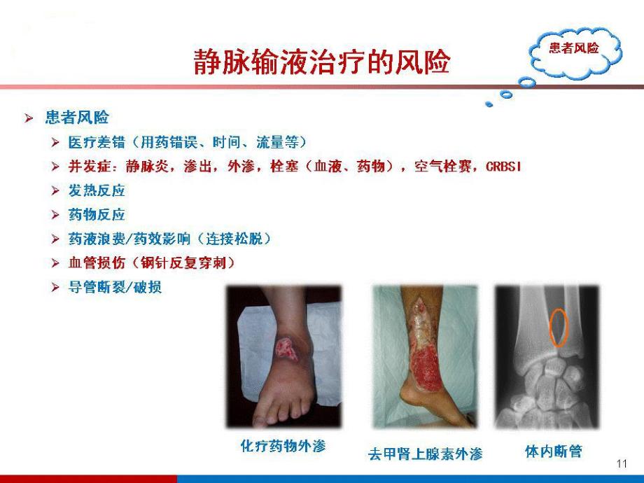 静脉治疗的安全管理ppt.ppt_第3页