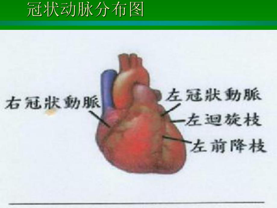 心肌梗死的护理.ppt_第3页