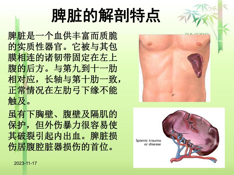 外伤性脾破裂的护理.ppt_第2页