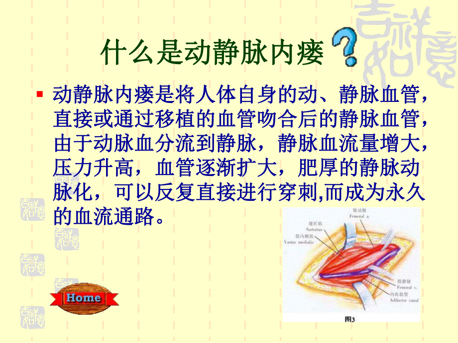 动静脉内瘘术及护理.ppt_第3页