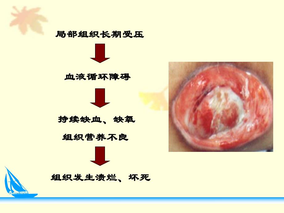 压疮预防及护理.ppt_第3页