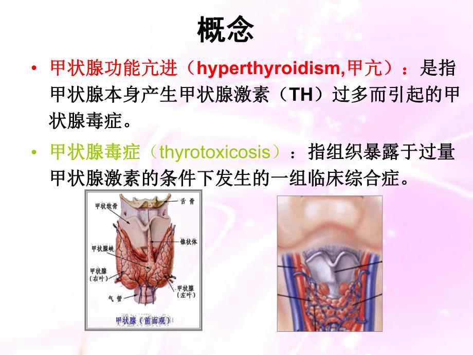 甲状腺功能亢进症病人的护理.ppt_第3页