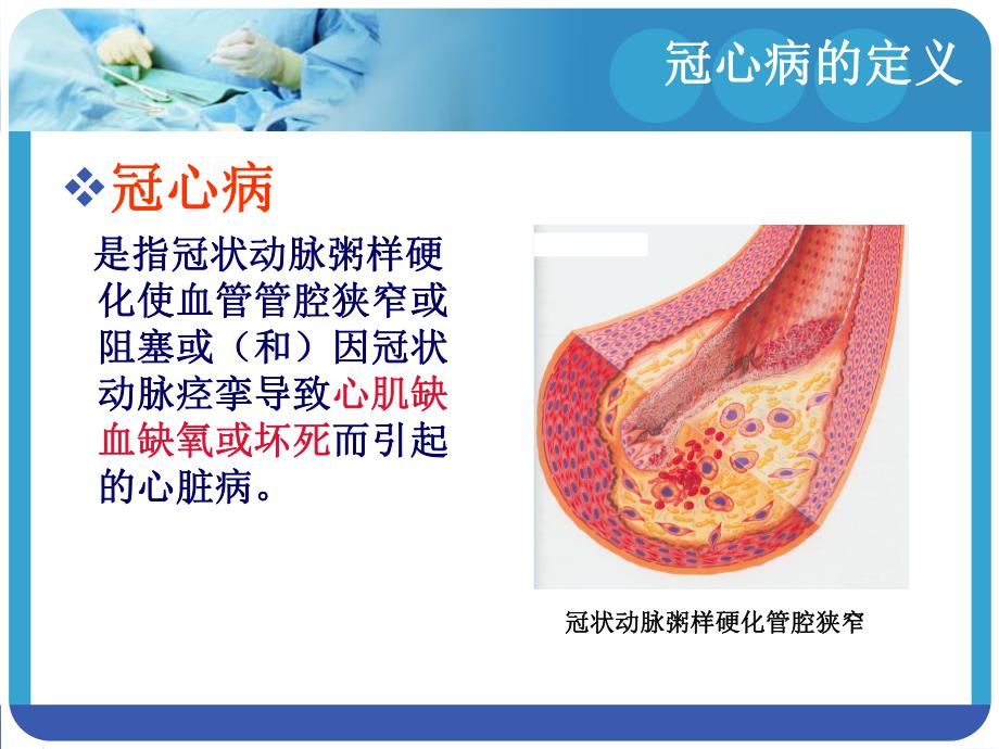 冠心病围术期的护理.ppt_第2页