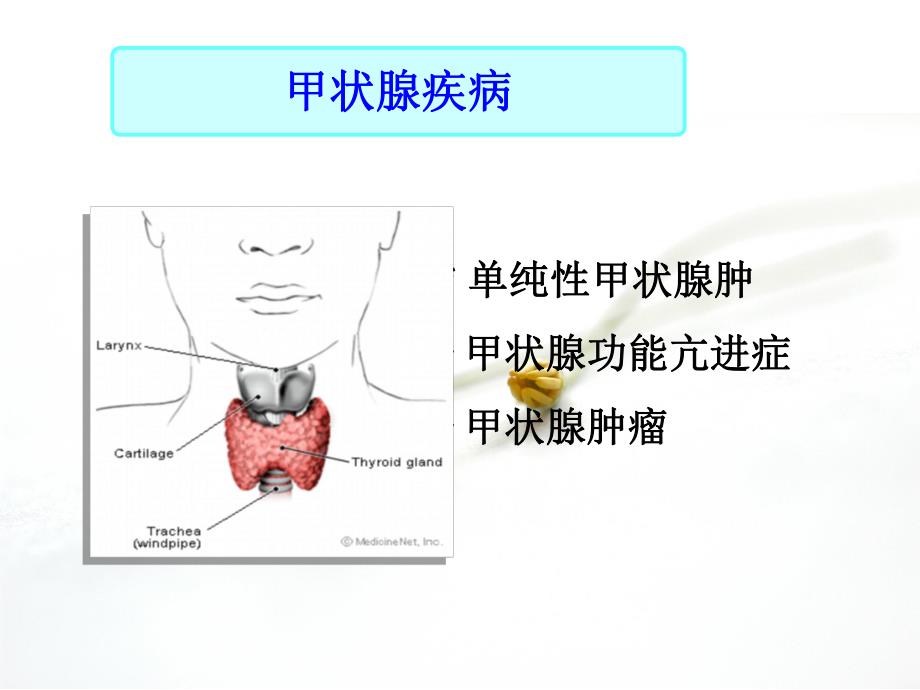 甲状腺疾病病人的护理.ppt_第3页