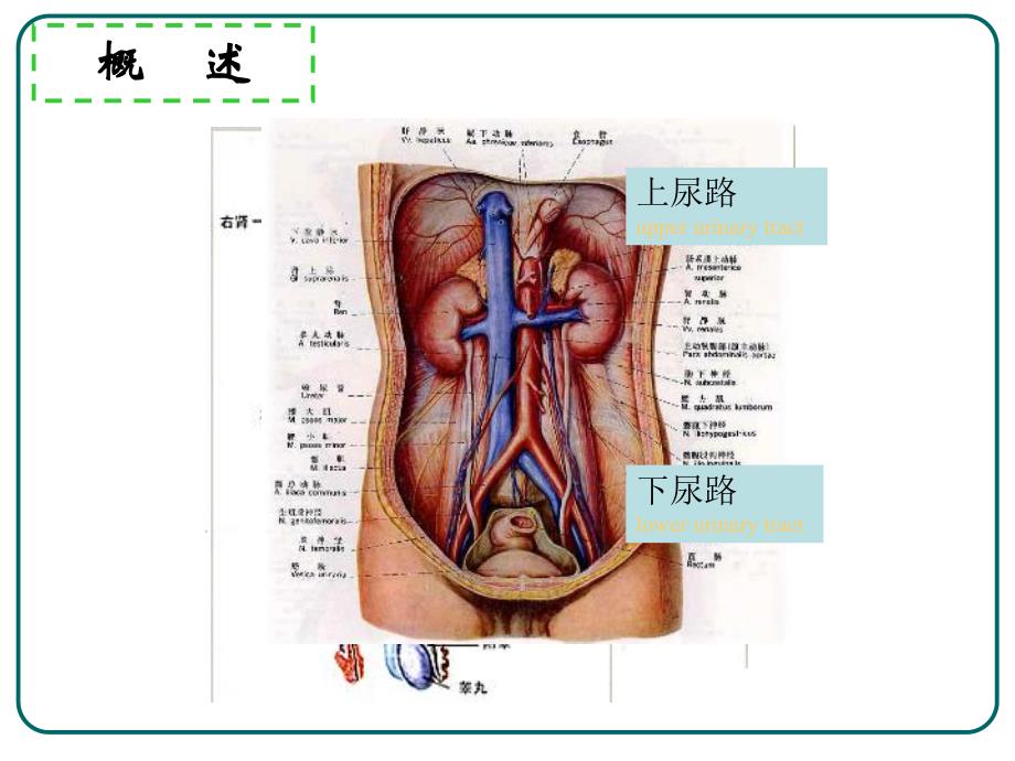 泌尿系损伤护理11.ppt_第3页