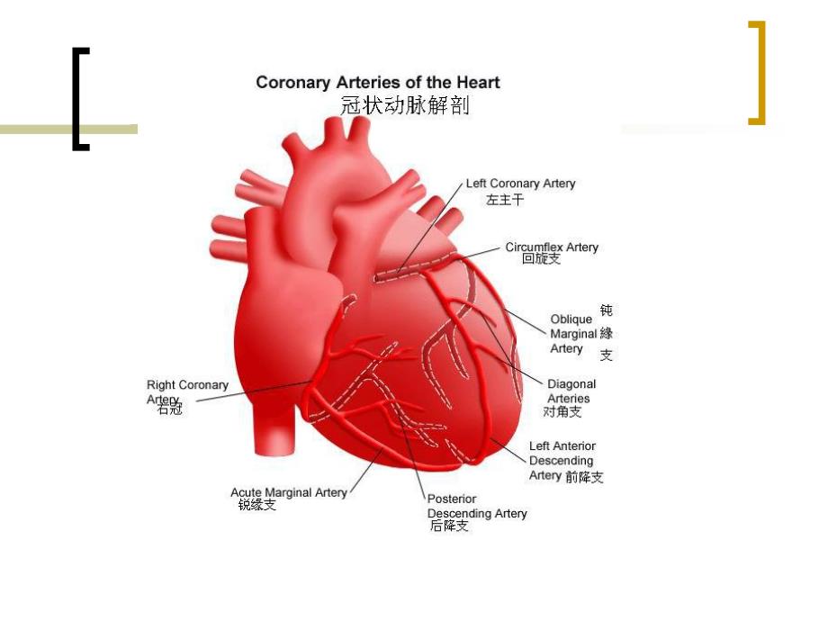 冠状动脉搭桥术后护理.ppt_第3页