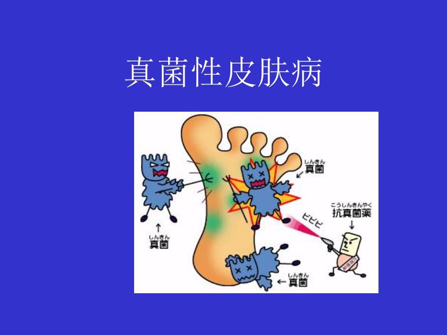 真菌性感染名师编辑PPT课件.ppt_第1页