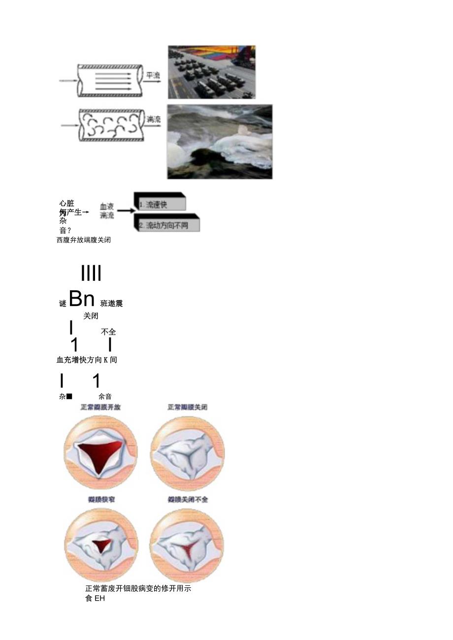 心脏瓣膜病考试重点总结.docx_第2页