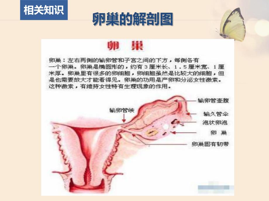 一例卵巢囊肿患者的护理查房摘要.ppt_第3页