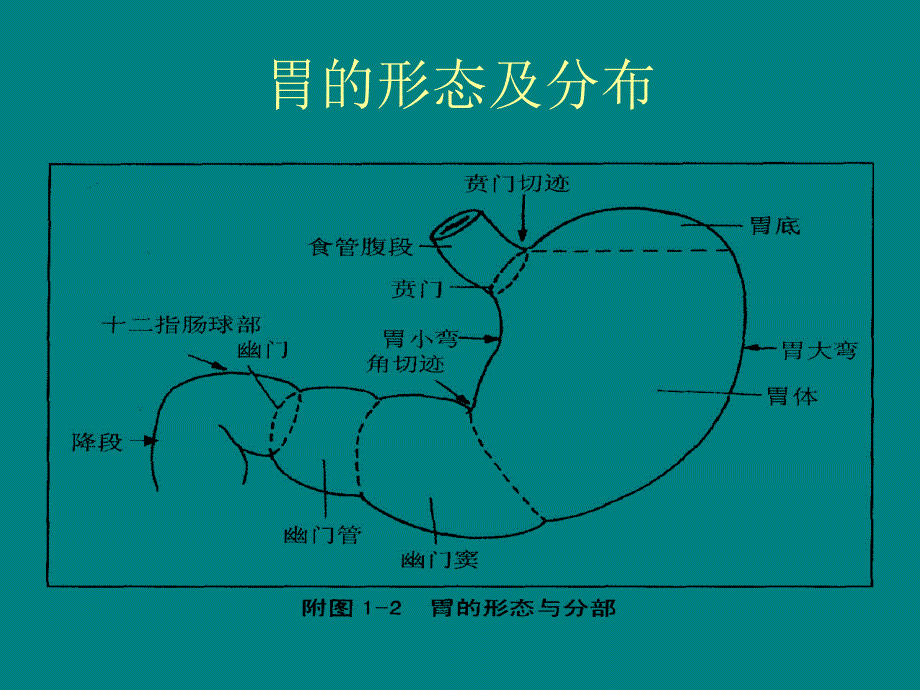 上消化道穿孔的护理.ppt_第3页