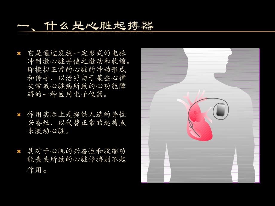 三腔起搏器治疗心衰的护理.ppt_第2页