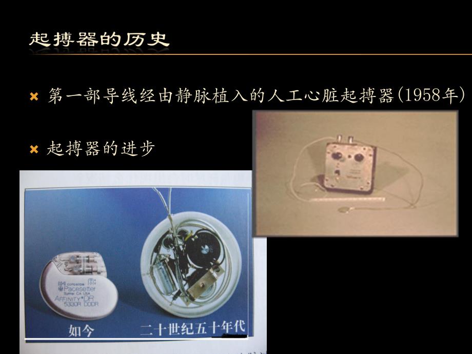 三腔起搏器治疗心衰的护理.ppt_第3页