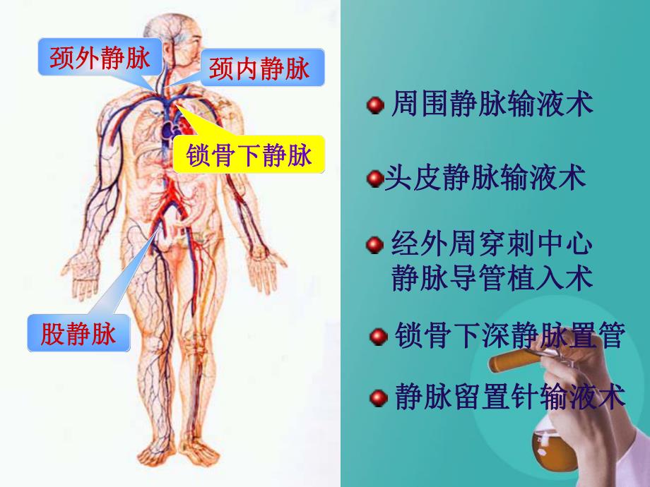 静脉留置针的护理.ppt_第2页