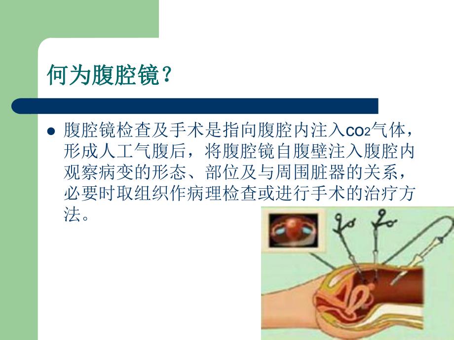 腹腔镜护理.ppt_第2页