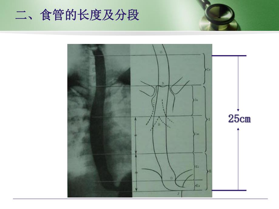 食管的常见疾病及其护理.ppt_第3页