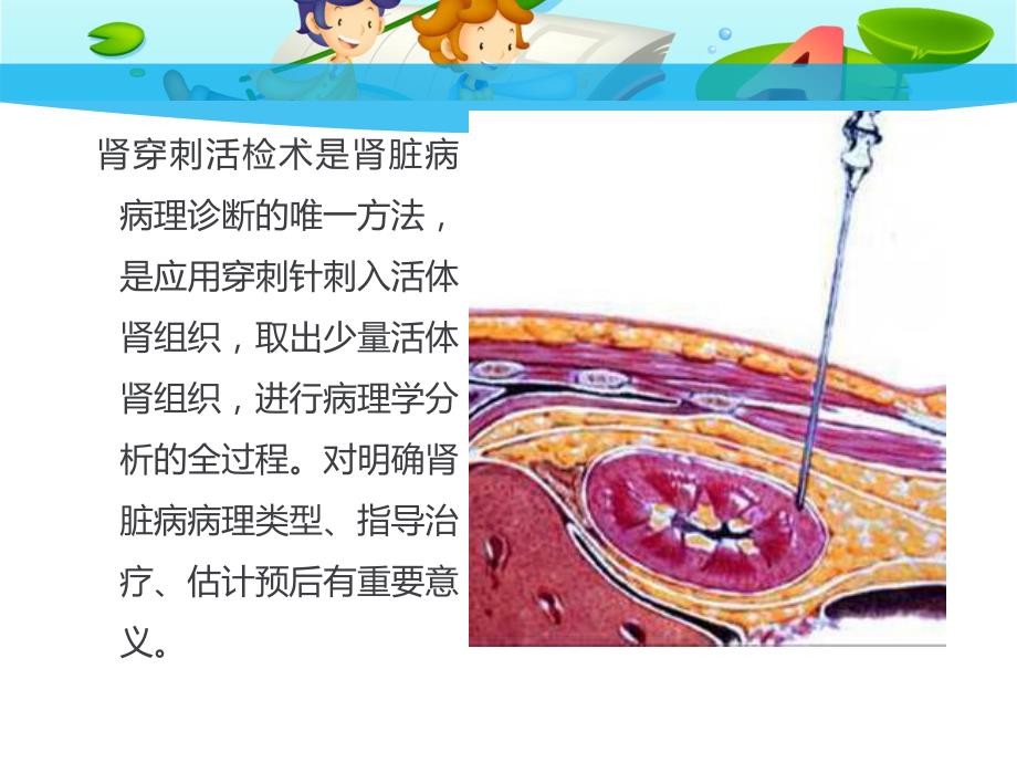 肾穿刺活检术教学查房.ppt_第3页