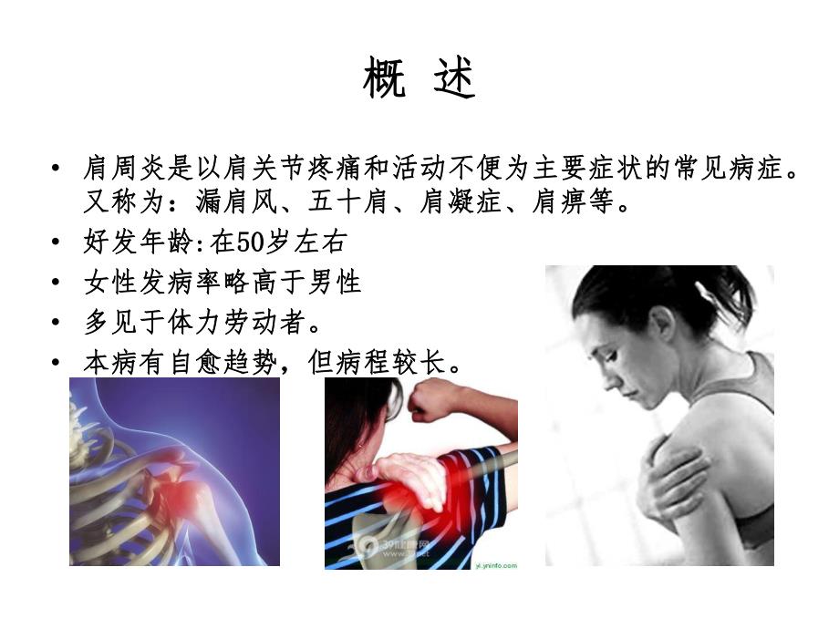 肩周炎的护理.ppt_第2页