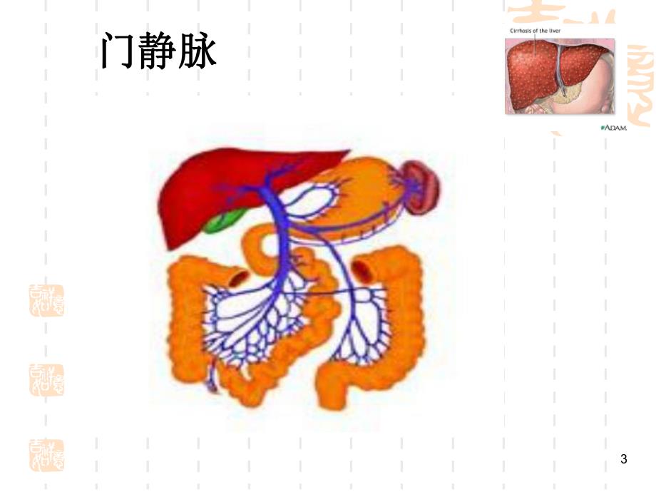 肝硬化病人的护理.ppt_第3页