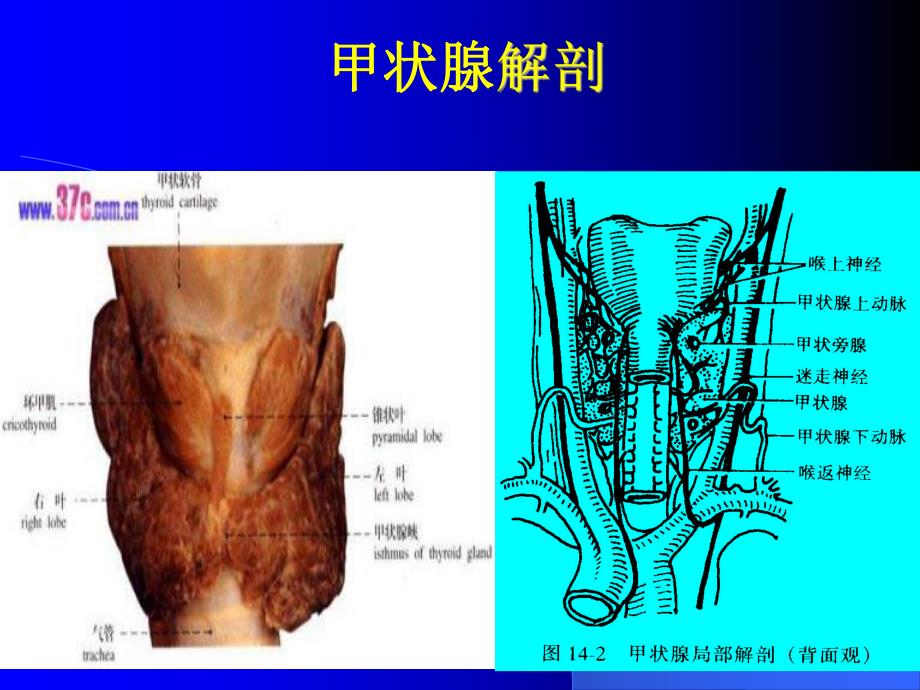 颈部疾病病人护理.ppt_第2页