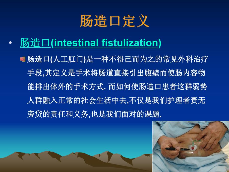 肠造口的护理.ppt_第2页