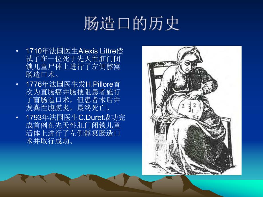 肠造口的护理.ppt_第3页