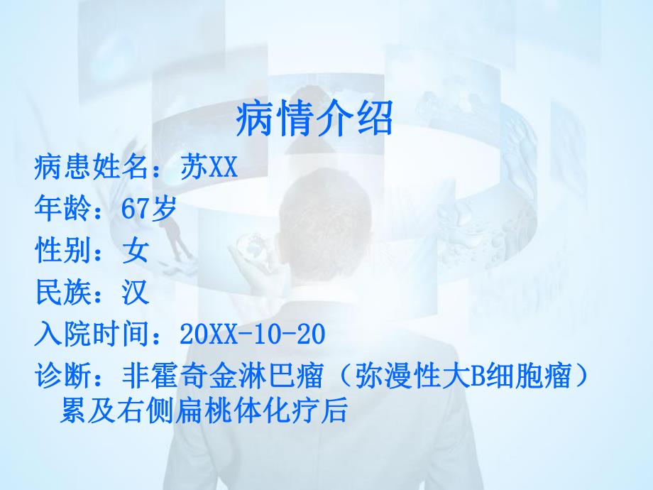 非霍奇金淋巴瘤的护理查房.ppt_第2页