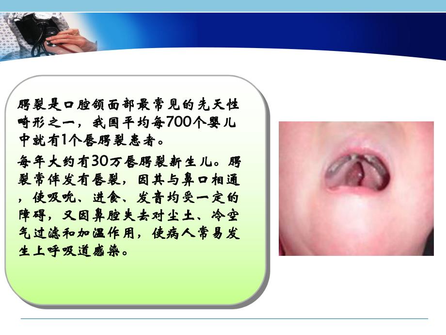 腭裂患者护理教学查房.ppt_第3页