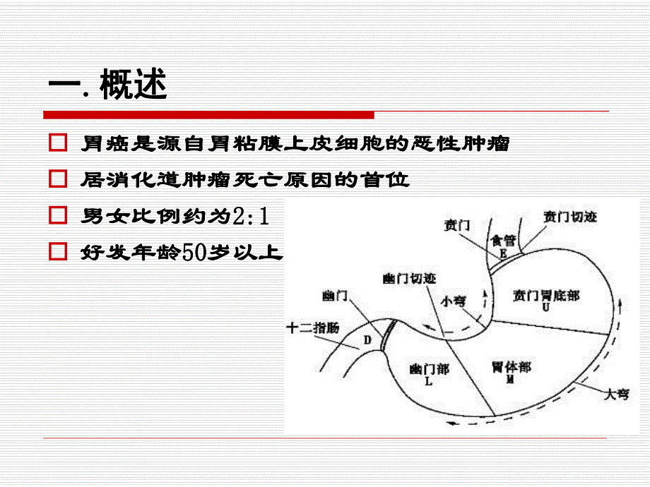 胃癌病人的护理1.ppt.ppt_第2页