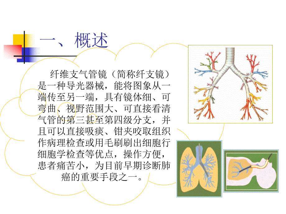 纤维支气管镜检查与护理.ppt.ppt_第3页