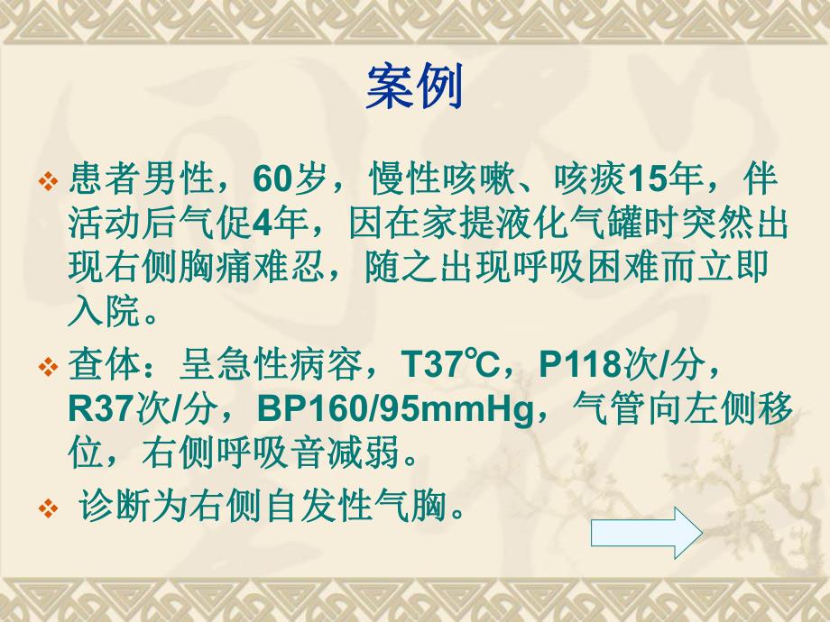 自发性气胸病人的护理.ppt.ppt_第2页