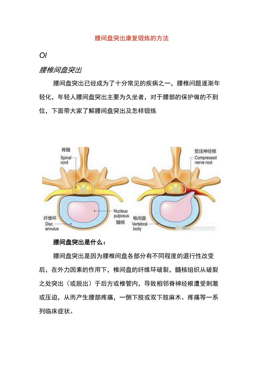 腰间盘突出康复锻炼的方法.docx_第1页