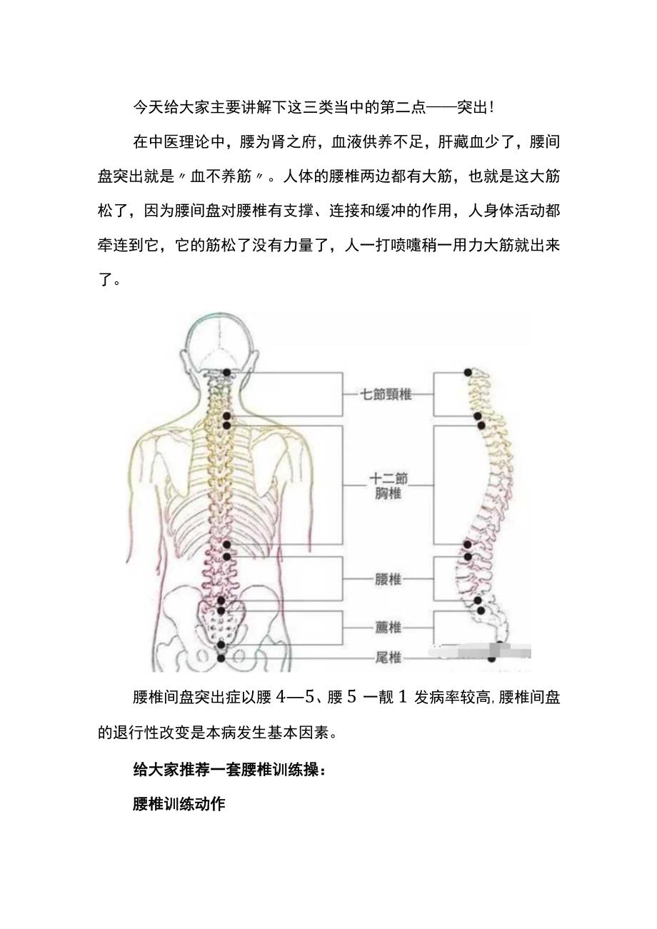 腰间盘突出康复锻炼的方法.docx_第3页