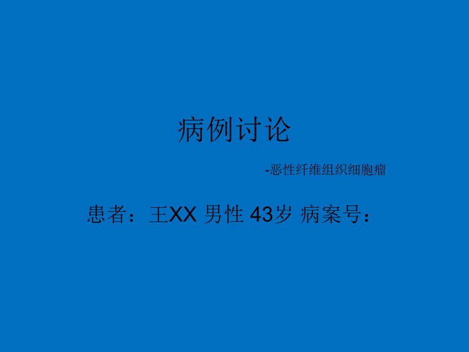 恶性纤维组织细胞瘤ppt幻灯片.ppt_第1页