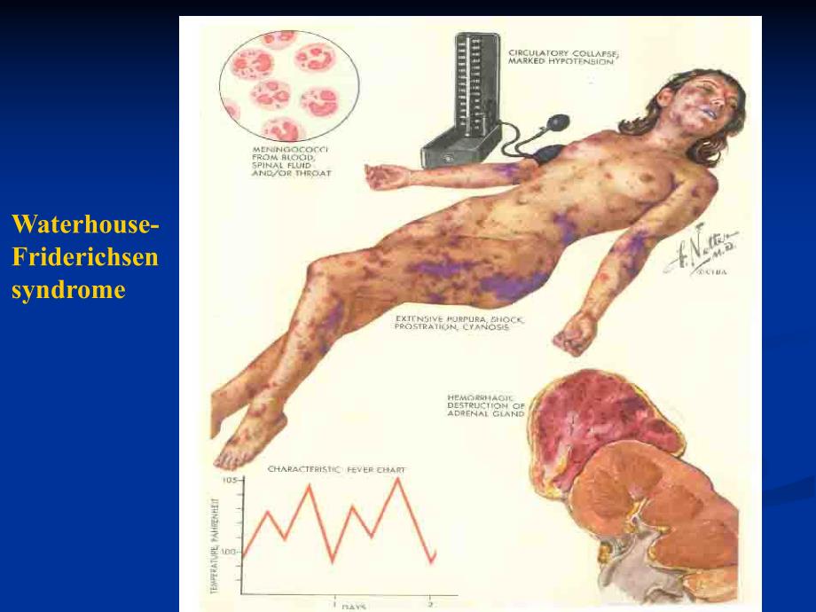 凝血与抗凝血平衡紊乱.ppt_第3页