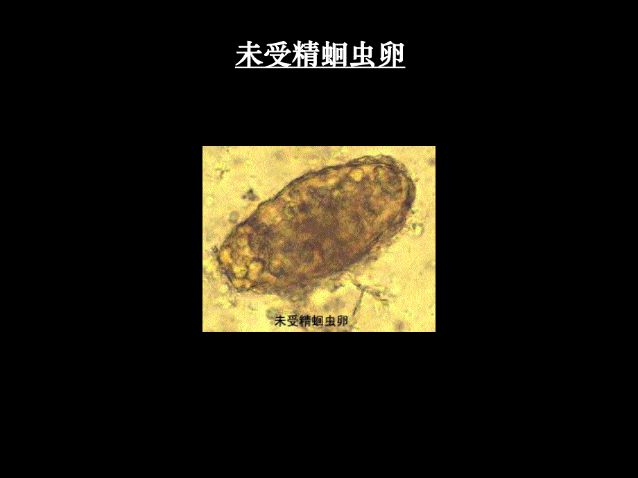 人体寄生虫标本考试.ppt_第3页