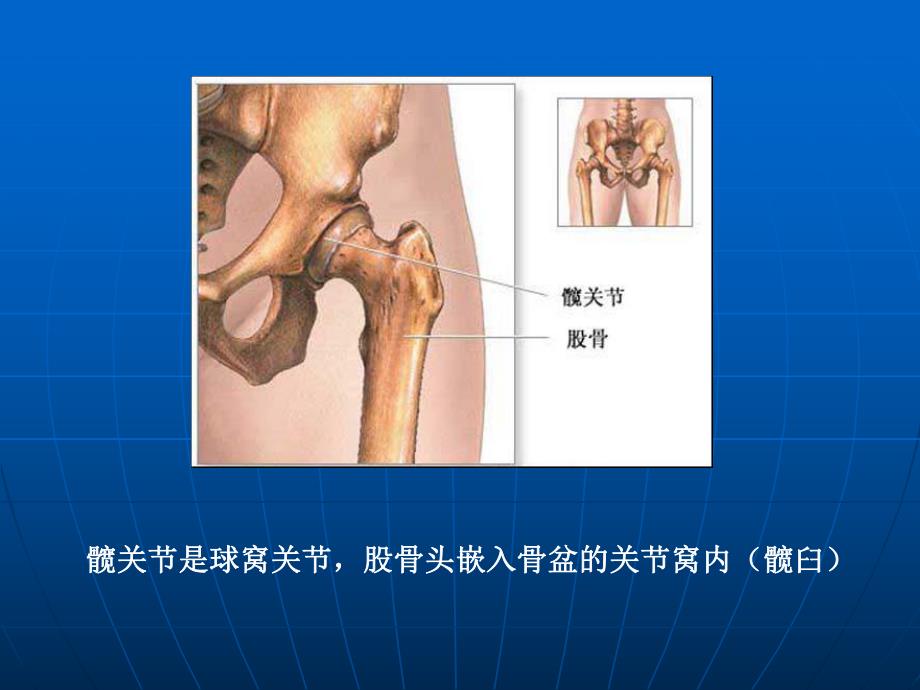 全髋关节置换术后康复训练修订版.ppt_第3页