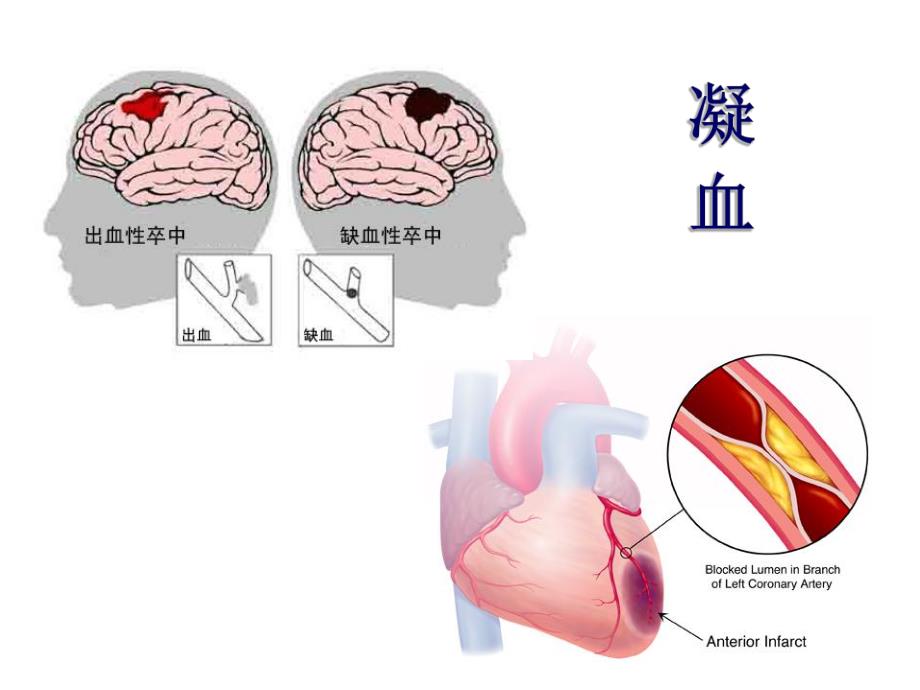 血液系统疾病的临床用药.ppt_第3页