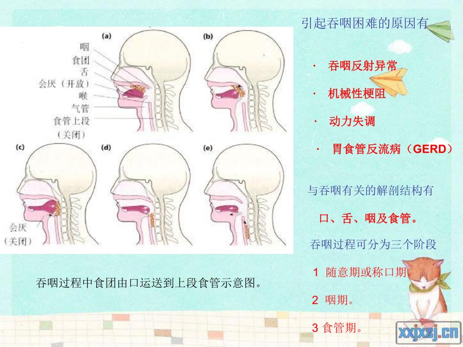 吞咽困难.ppt_第3页