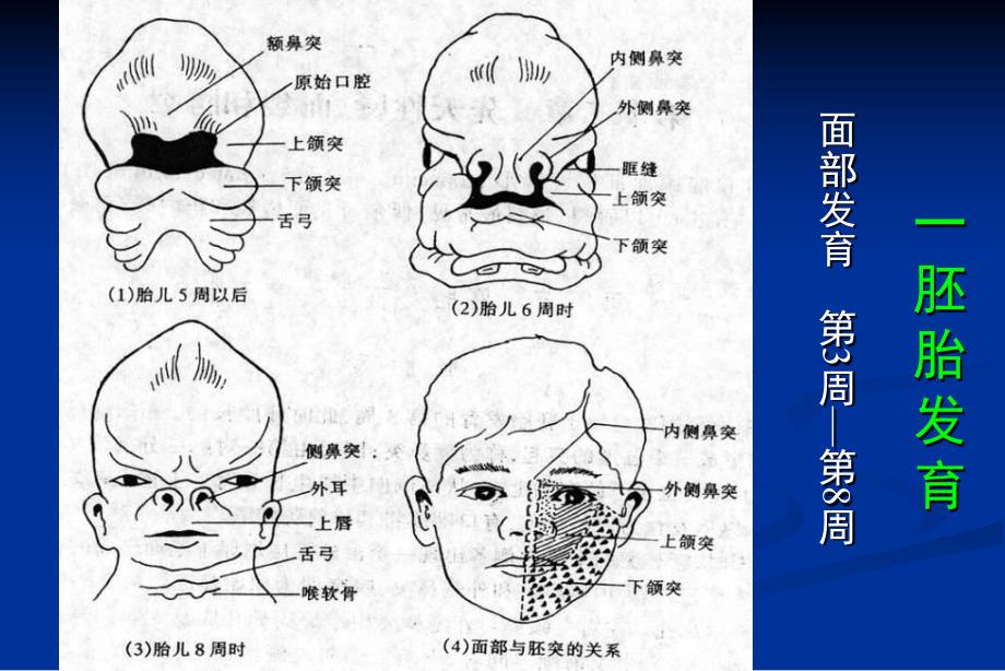 【临床医学】27 先天性唇、面裂和腭裂.ppt_第3页