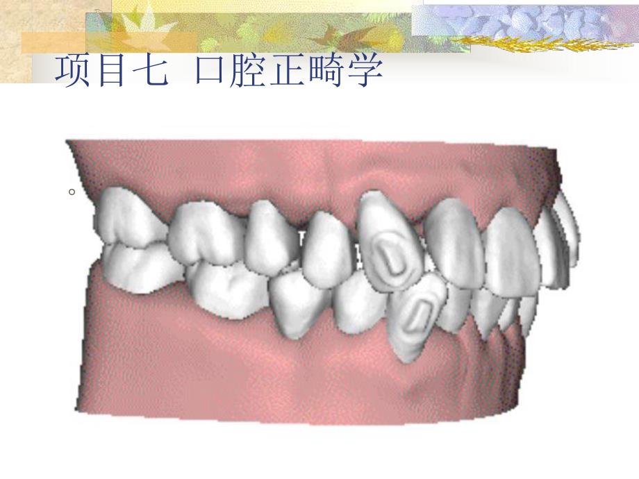 口腔正畸学概述..ppt_第2页