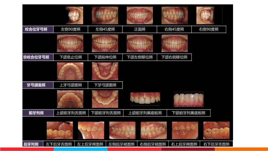 口腔医学美学第三章 口腔摄影.ppt_第3页